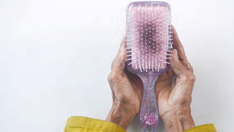 Dites adieu à la calvitie : 5 façons efficaces de cacher la perte de cheveux chez les femmes